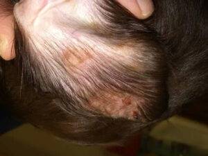 Immune-Mediated Ear Flap